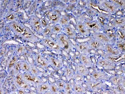 2 - Anti-IGF1 Receptor Picoband Antibody ABO12800