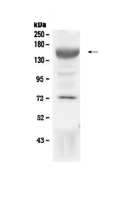 1 - Anti-IGF1 Receptor Picoband Antibody ABO12800