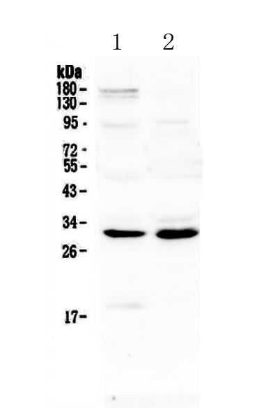 1 - Anti-IL1 beta Picoband Antibody ABO12802