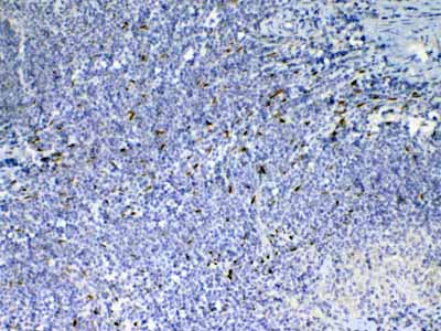 2 - Anti-IL33 Picoband Antibody ABO12805