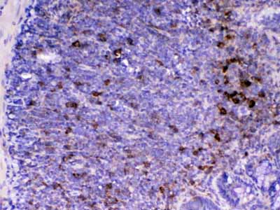 2 - Anti-CD14 Picoband Antibody ABO12806