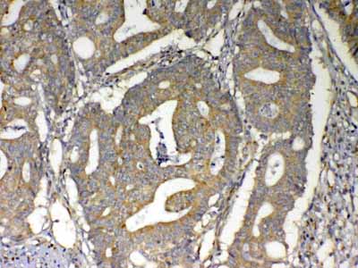 2 - Anti-MAVS Picoband Antibody ABO12808
