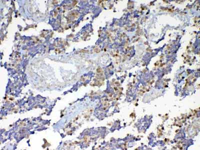 2 - Anti-Dnmt1 Picoband Antibody ABO12809