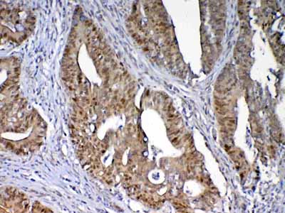 2 - Anti-Dnmt1 Picoband Antibody ABO12809