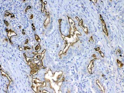 2 - Anti-MUC1 Picoband Antibody ABO12811