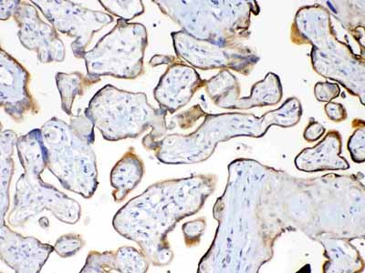 2 - Anti-MUC1 Picoband Antibody ABO12811
