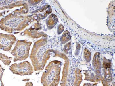 2 - Anti-MUC1 Picoband Antibody ABO12811