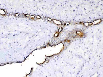 2 - Anti-MUC1 Picoband Antibody ABO12811