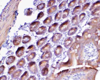 2 - Anti-Flt3 / CD135 Picoband Antibody ABO12813