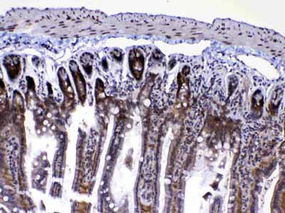 2 - Anti-Ran Picoband Antibody ABO12814