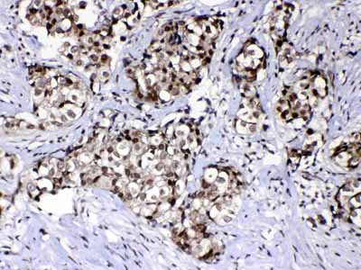 2 - Anti-Ran Picoband Antibody ABO12814
