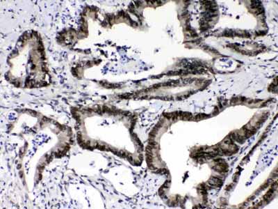 2 - Anti-Ran Picoband Antibody ABO12814