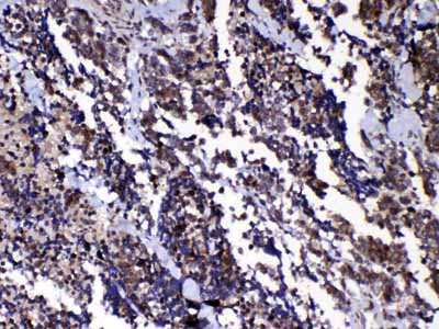2 - Anti-Ran Picoband Antibody ABO12814