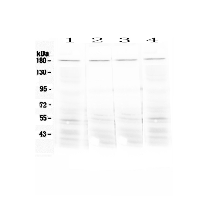 1 - Anti-Ace Picoband Antibody ABO12817