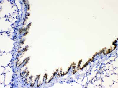 2 - Anti-AGRP Picoband Antibody ABO12821