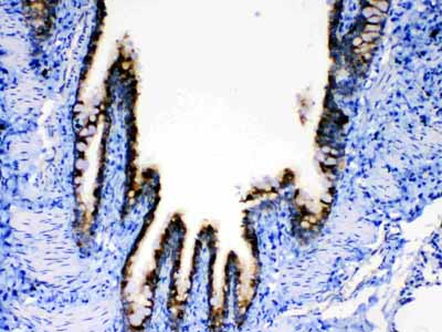 2 - Anti-AGRP Picoband Antibody ABO12821