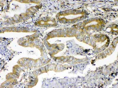 2 - Anti-ErbB 4 Picoband Antibody ABO12823