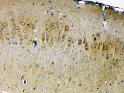 2 - Anti-ErbB 4 Picoband Antibody ABO12823