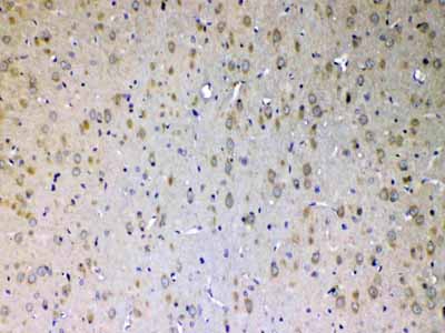 2 - Anti-ErbB 4 Picoband Antibody ABO12823