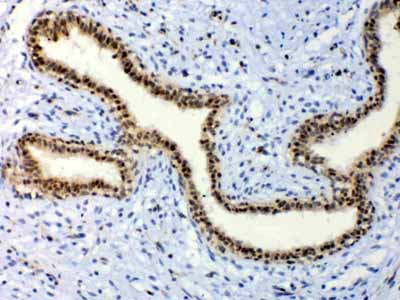 2 - Anti-ETV6/Tel Picoband Antibody ABO12827