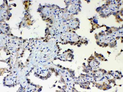 2 - Anti-ETV6/Tel Picoband Antibody ABO12827