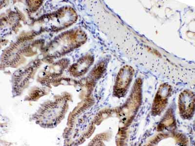 2 - Anti-ETV6/Tel Picoband Antibody ABO12827