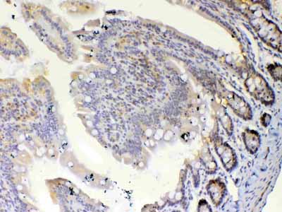 2 - Anti-ETV6/Tel Picoband Antibody ABO12827