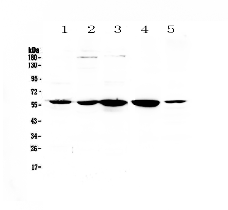 1 - Anti-ETV6/Tel Picoband Antibody ABO12827