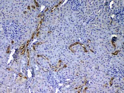 2 - Anti-EGF Picoband Antibody ABO12828
