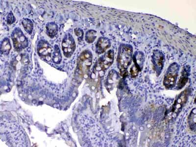 2 - Anti-EGF Picoband Antibody ABO12828