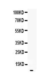 1 - Anti-EGF Picoband Antibody ABO12828