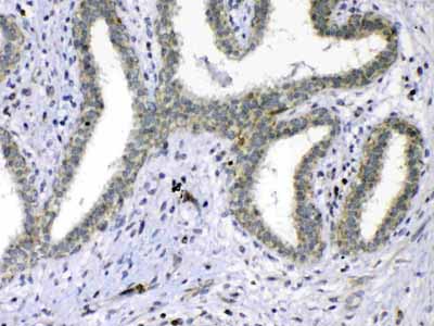 2 - Anti-Cdc20 Picoband Antibody ABO12829