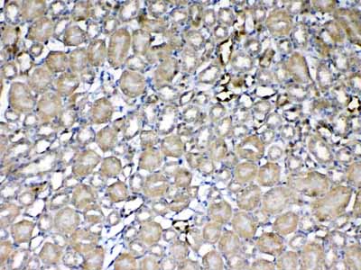 2 - Anti-GST3 / GST pi Picoband Antibody ABO12831