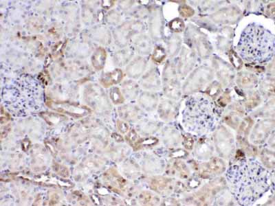 2 - Anti-GST3 / GST pi Picoband Antibody ABO12831