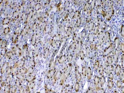 2 - Anti-GST3 / GST pi Picoband Antibody ABO12832