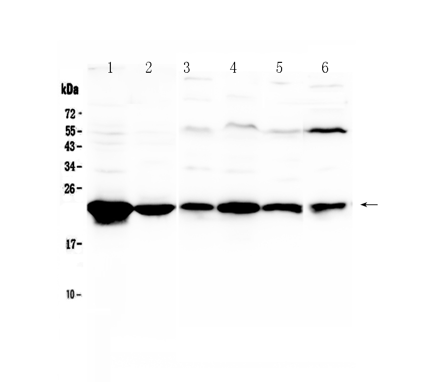 1 - Anti-GST3 / GST pi Picoband Antibody ABO12832