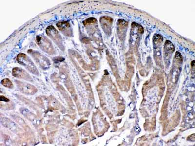 2 - Anti-MMP13 Picoband Antibody ABO12834
