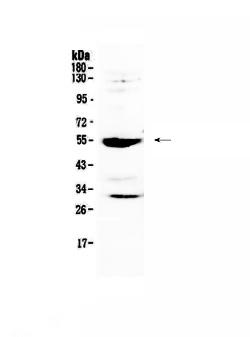 1 - Anti-MMP13 Picoband Antibody ABO12834
