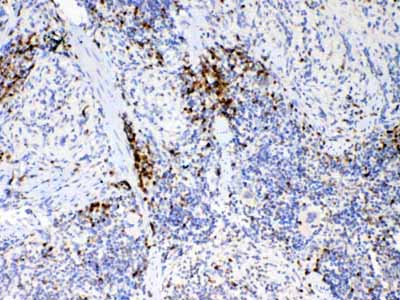 2 - Anti-IL17 Picoband Antibody ABO12835