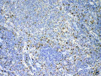 2 - Anti-IL17 Picoband Antibody ABO12835