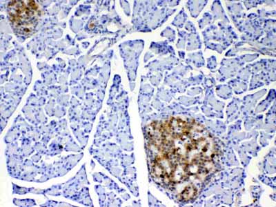 2 - Anti-IL17 Picoband Antibody ABO12835