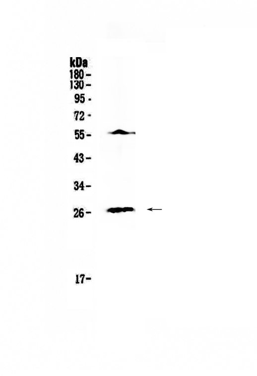 1 - Anti-IL17 Picoband Antibody ABO12835