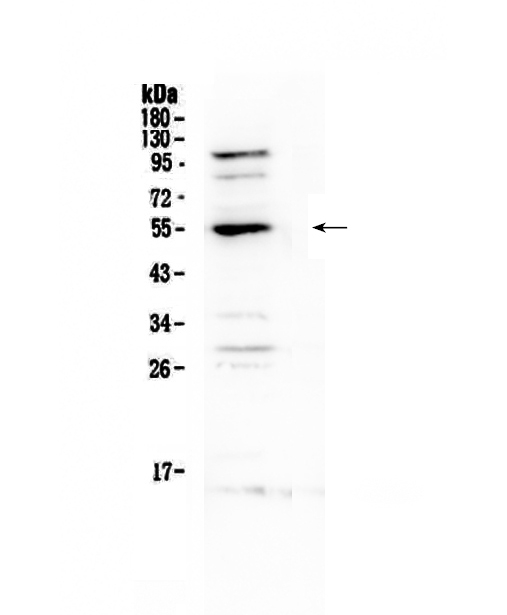 1 - Anti-EPO Receptor Picoband Antibody ABO12838