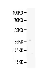 1 - Anti-IGFBP3 Picoband Antibody ABO12840