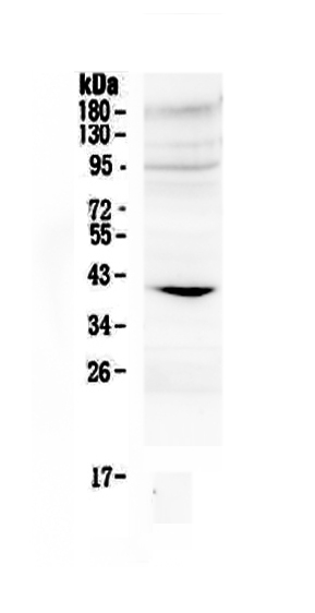 1 - Anti-IGFBP3 Picoband Antibody ABO12841