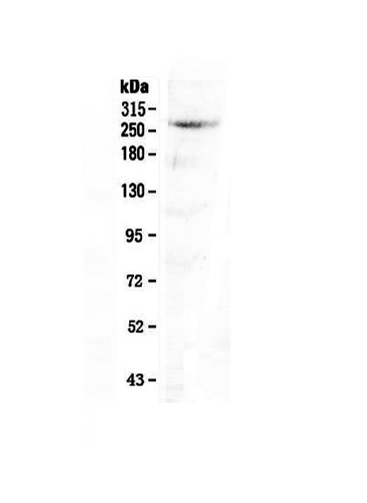 1 - Anti-CAD antibody ABO12844
