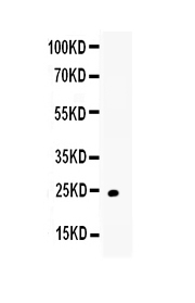 1 - Anti-TRAIL Picoband Antibody ABO12845
