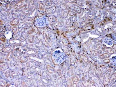 2 - Anti-Galectin 1 Picoband Antibody ABO12846