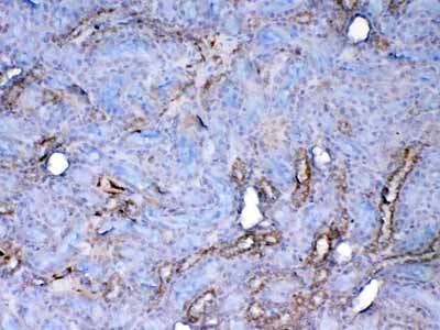 2 - Anti-Galectin 1 Picoband Antibody ABO12846