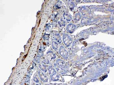 2 - Anti-Galectin 1 Picoband Antibody ABO12846